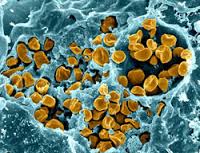 Cryptococcus gattii